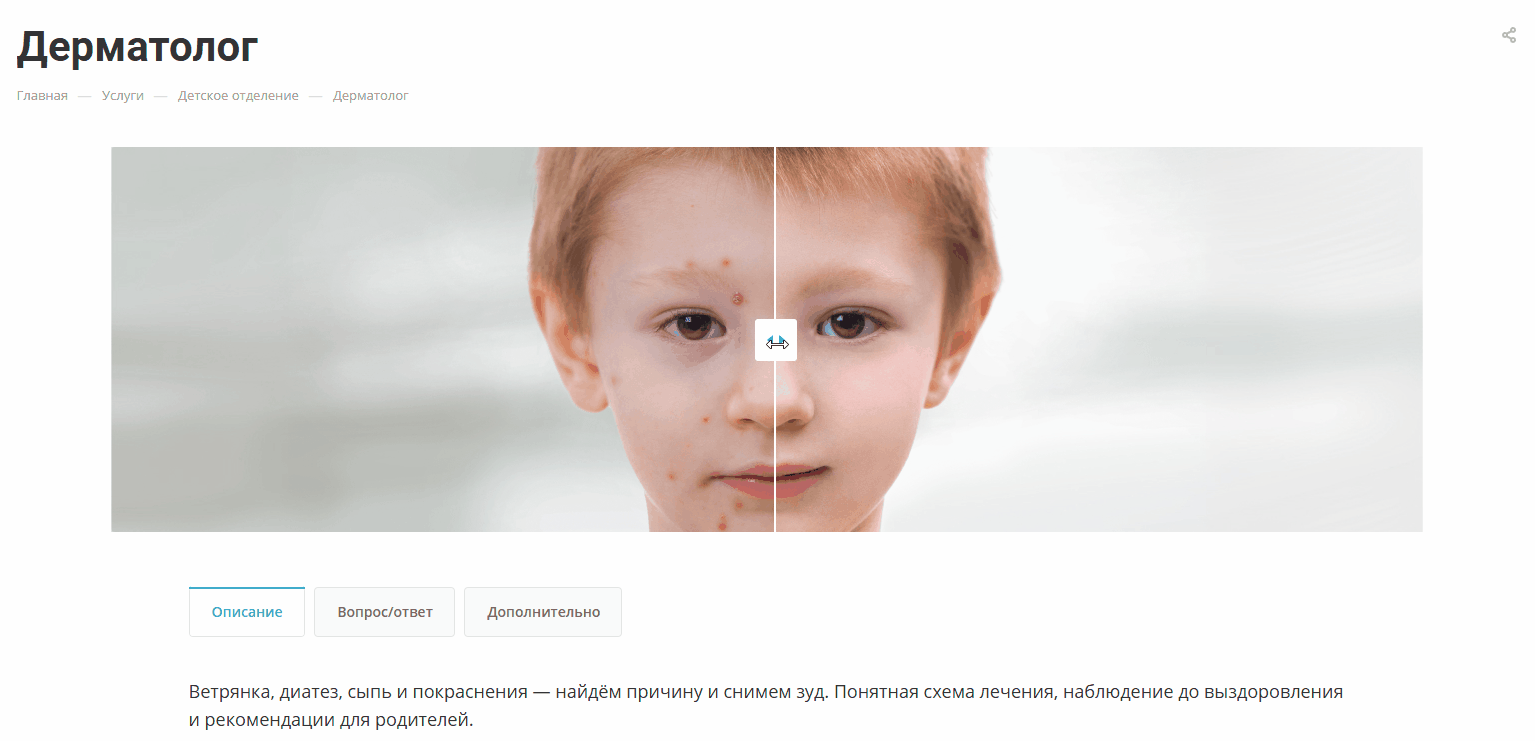 Покадровое сравнение изображений